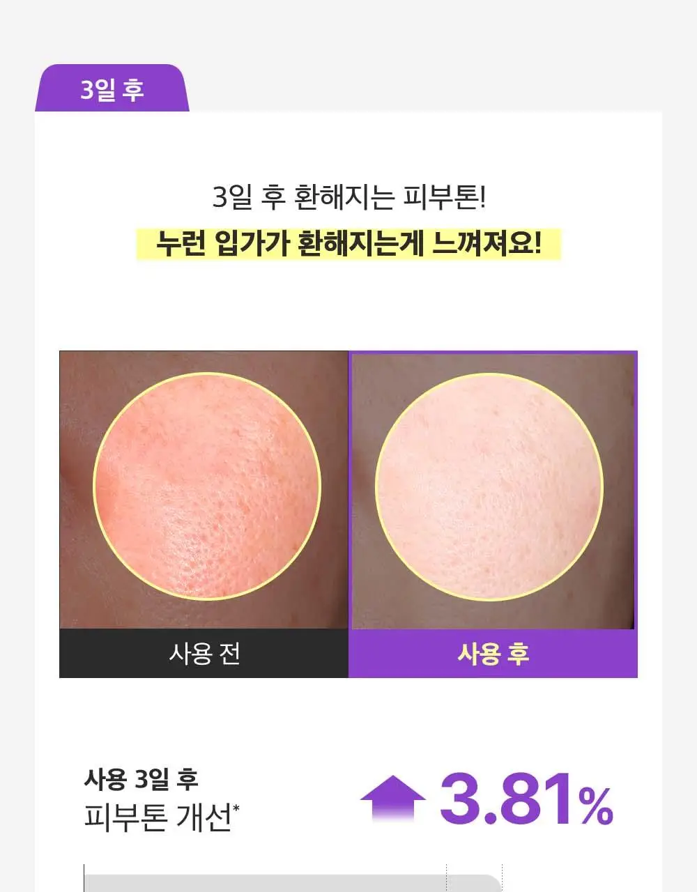 [포켓몬 에디션/잡티미백]성분에디터 머루포도 비타씨 다크 스팟 앰플 40ml 더블기획* 상세페이지 33